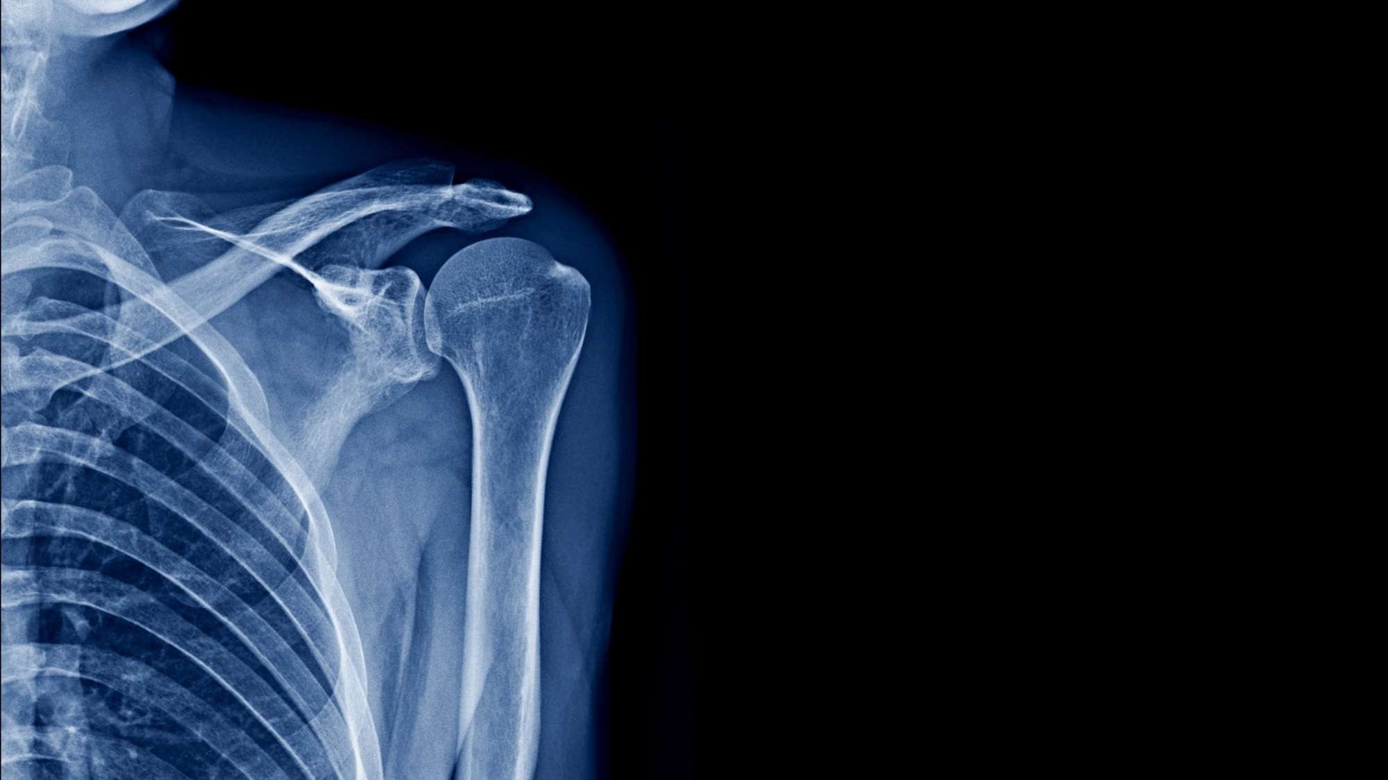 King City Diagnostic Imaging – X-Ray X-ray and ultrasound services available while you wait for a CT scan in Ontario