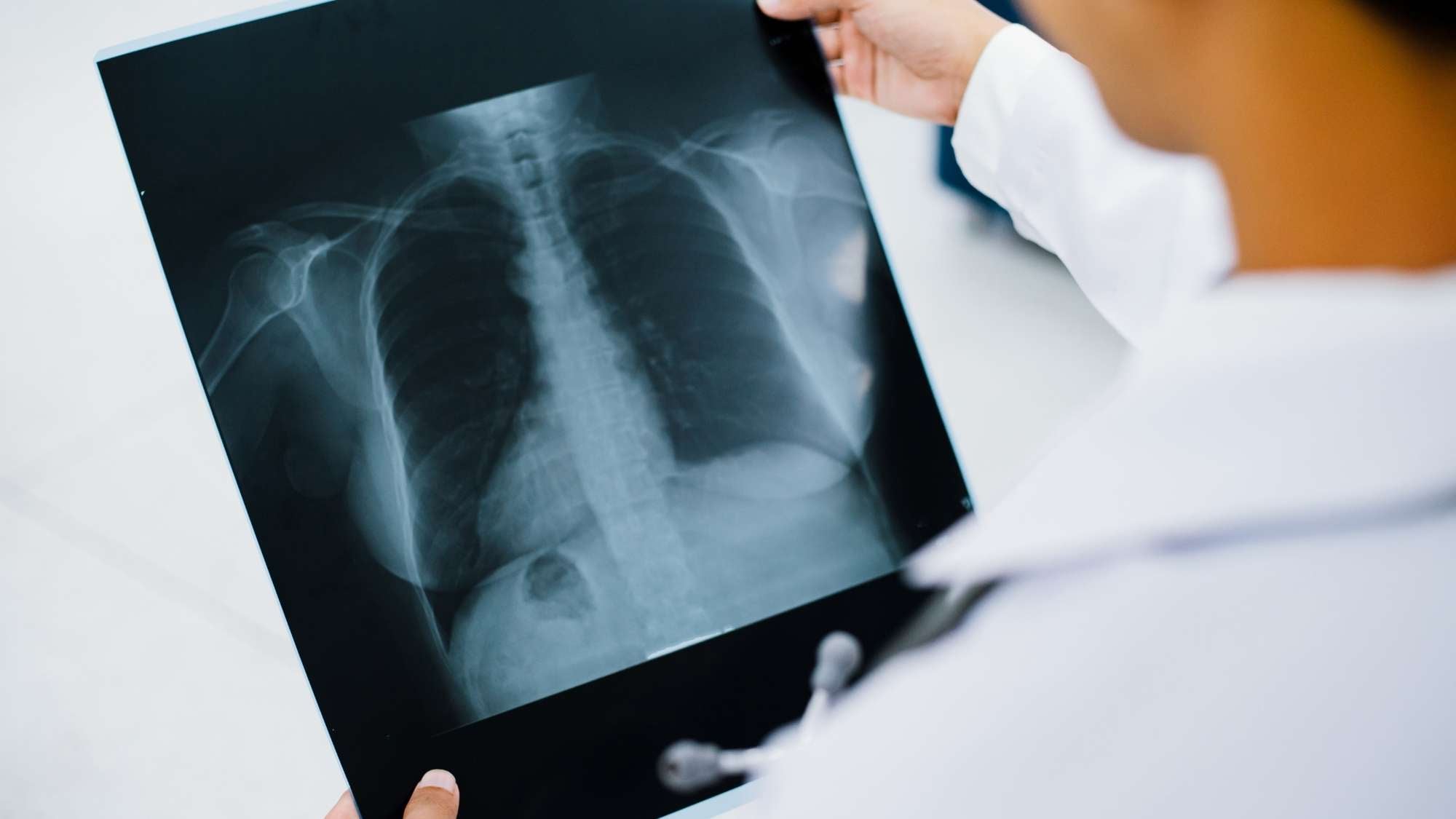 Walk-in X-ray Richmond Hill and Aurora patients can use without an appointment