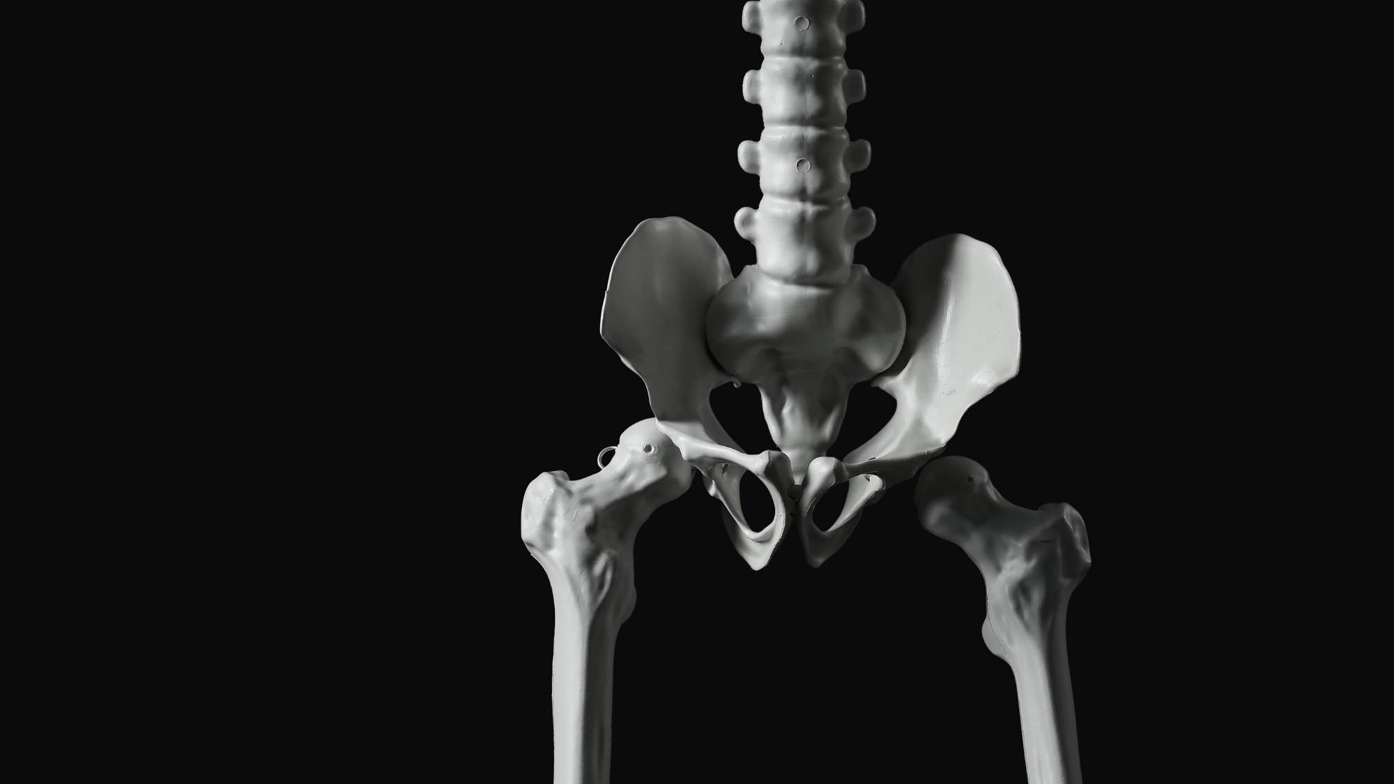 DEXA bone density scanner measuring the lumbar spine and hip
