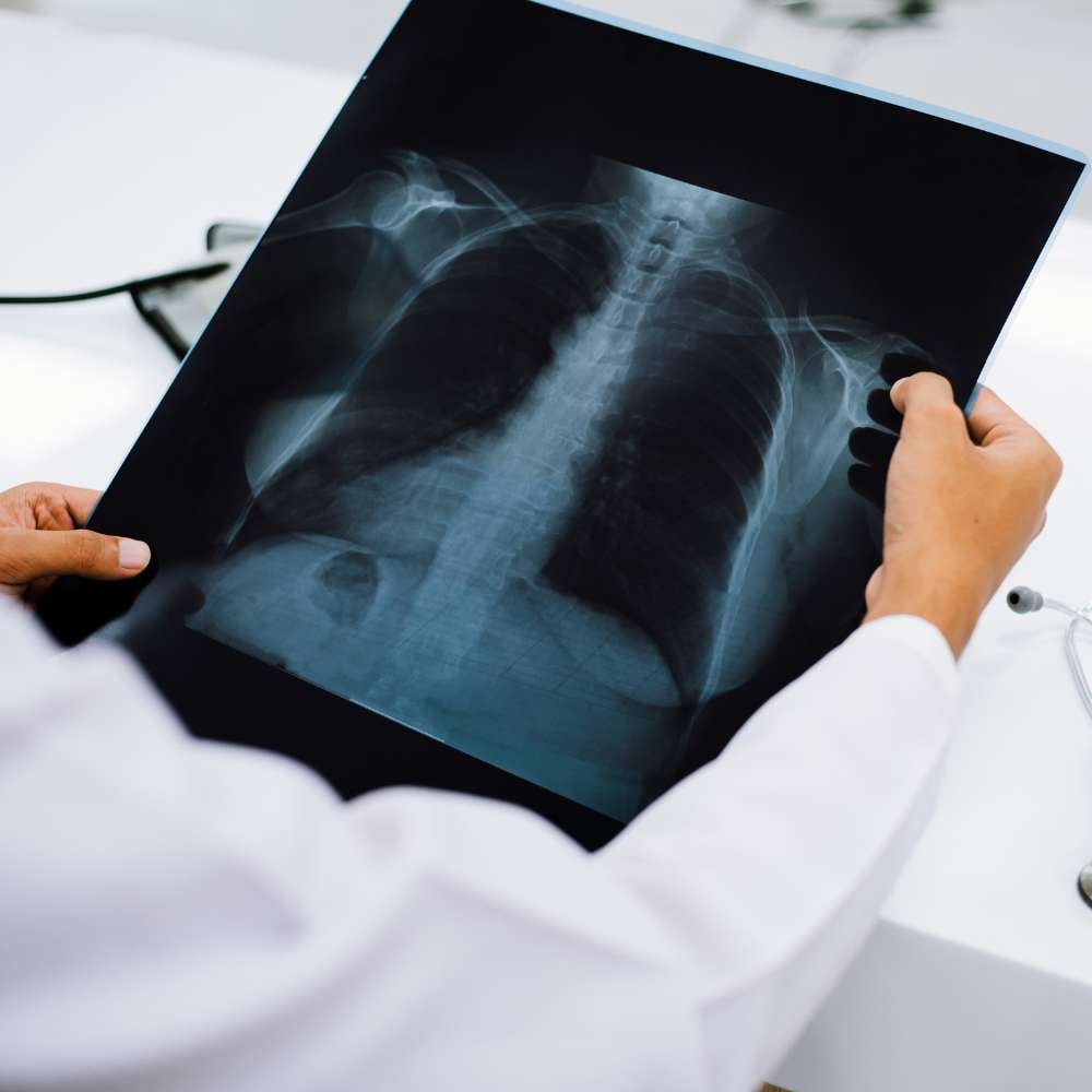 X-ray King City – digital X-ray imaging at King City Diagnostic Imaging
