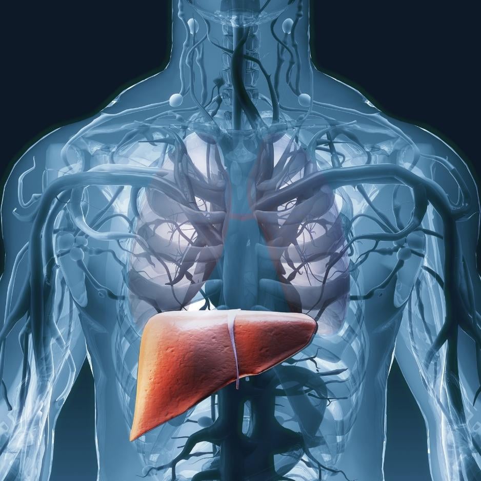 Fibroscan