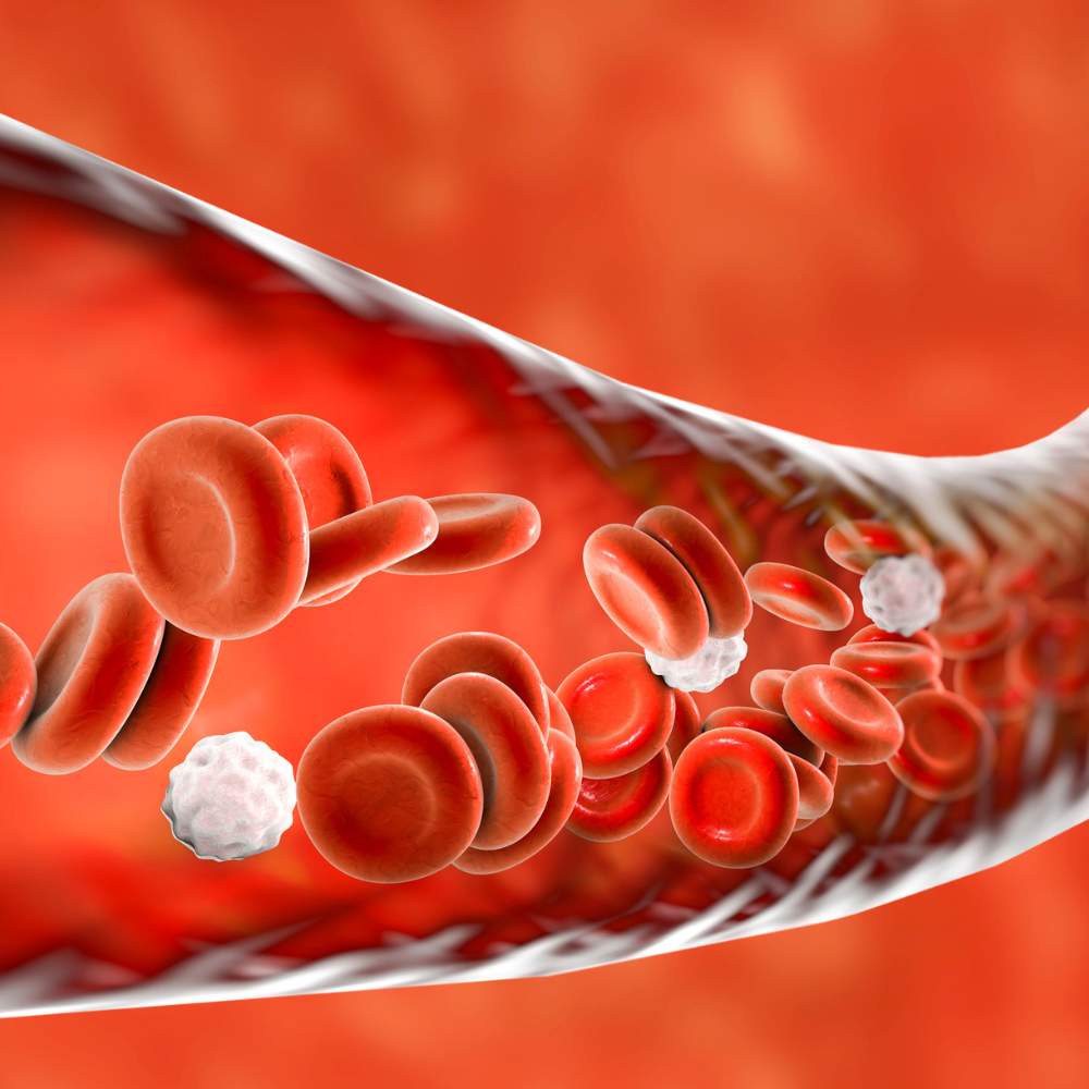 Vascular Ultrasound