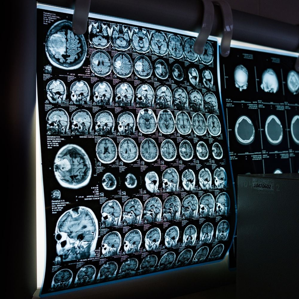 CT scan King City – CT imaging at King City Diagnostic Imaging